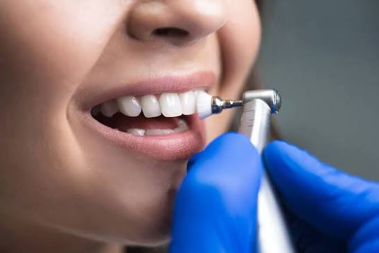Dental Clean
