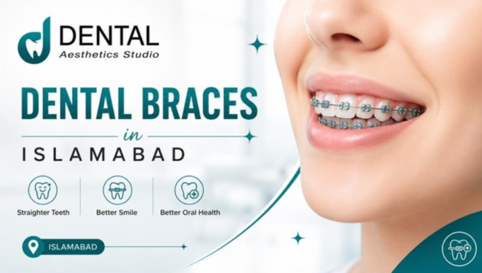 Will Teeth Move 10 Years After Braces?